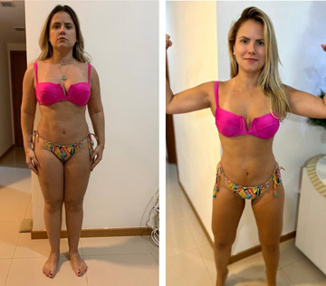 antesdepois-1
