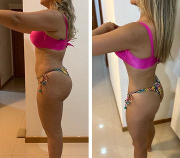 antesdepois-2