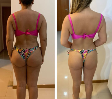 antesdepois-3