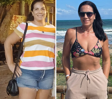 antesdepois-5